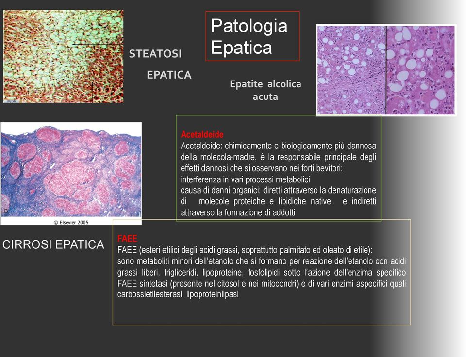 attraverso la formazione di addotti CIRROSI EPATICA FAEE FAEE (esteri etilici degli acidi grassi, soprattutto palmitato ed oleato di etile): sono metaboliti minori dell etanolo che si formano per