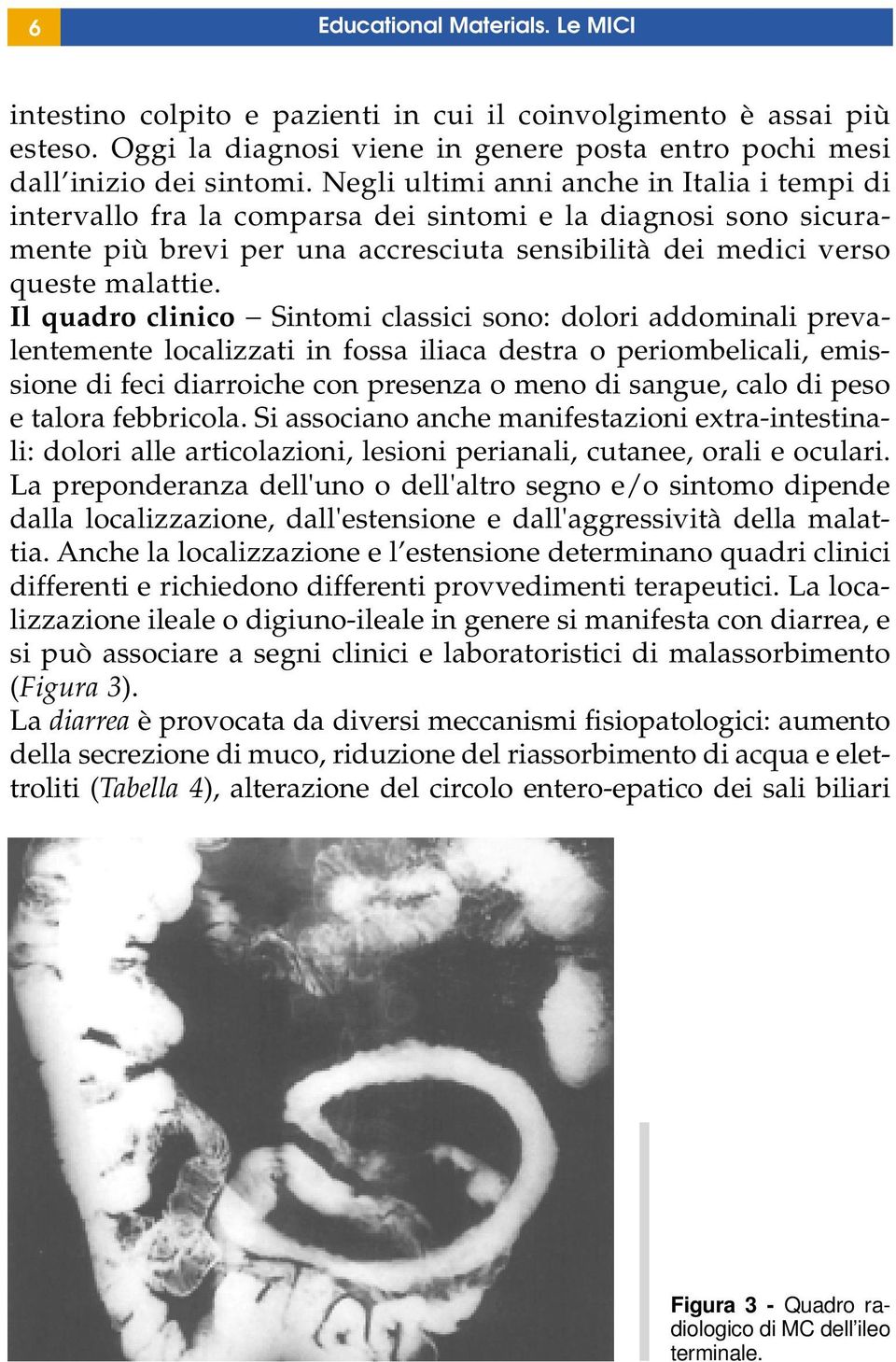 Il quadro clinico Sintomi classici sono: dolori addominali prevalentemente localizzati in fossa iliaca destra o periombelicali, emissione di feci diarroiche con presenza o meno di sangue, calo di