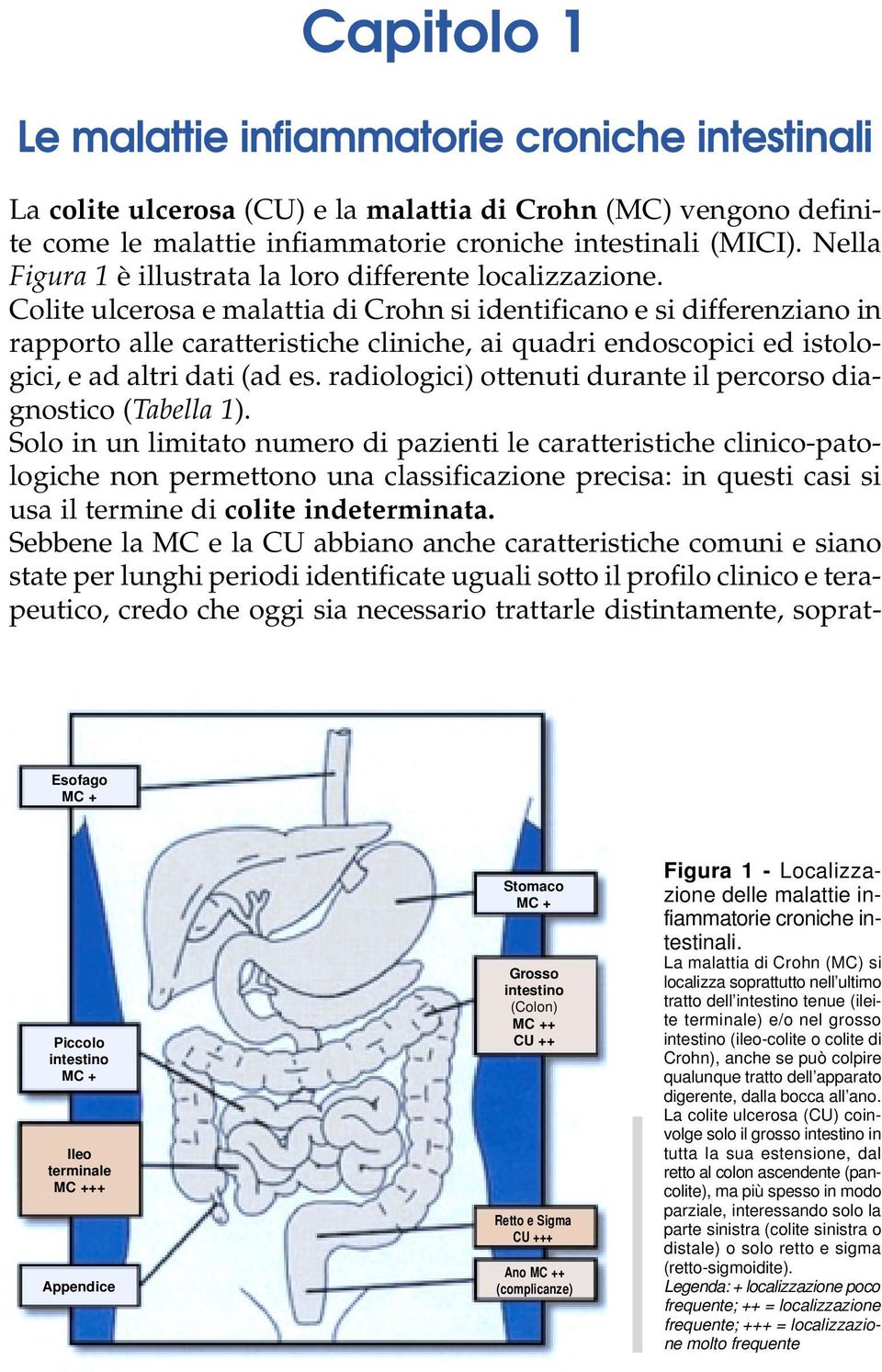 Colite ulcerosa e malattia di Crohn si identificano e si differenziano in rapporto alle caratteristiche cliniche, ai quadri endoscopici ed istologici, e ad altri dati (ad es.