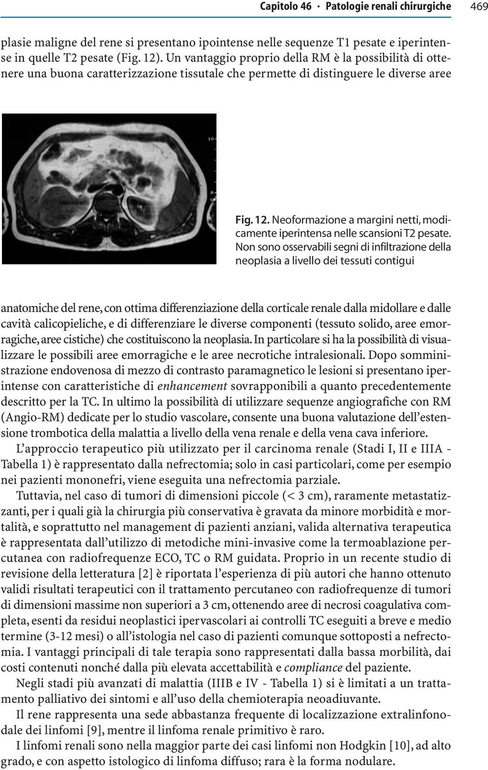 Neoformazione a margini netti, modicamente iperintensa nelle scansioni T2 pesate.