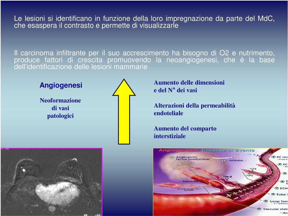 promuovendo la neoangiogenesi, che è la base dell identificazione delle lesioni mammarie Angiogenesi Neoformazione di vasi