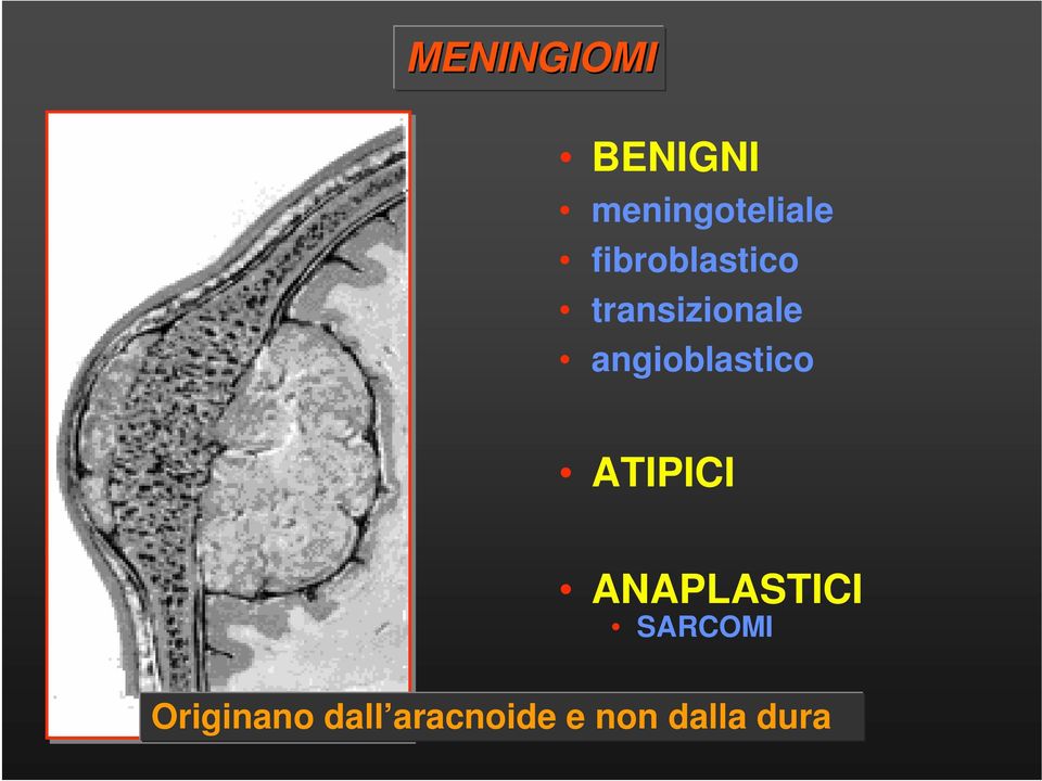 angioblastico ATIPICI ANAPLASTICI
