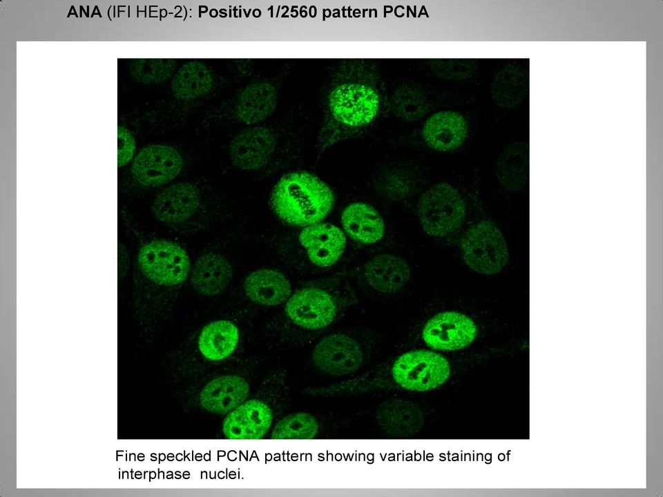 speckled PCNA pattern showing