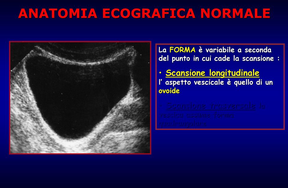 longitudinale l aspetto vescicale è quello di un ovoide