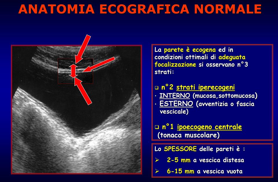 (mucosa,sottomucosa) ESTERNO (avventizia o fascia vescicale) n 1 ipoecogeno centrale