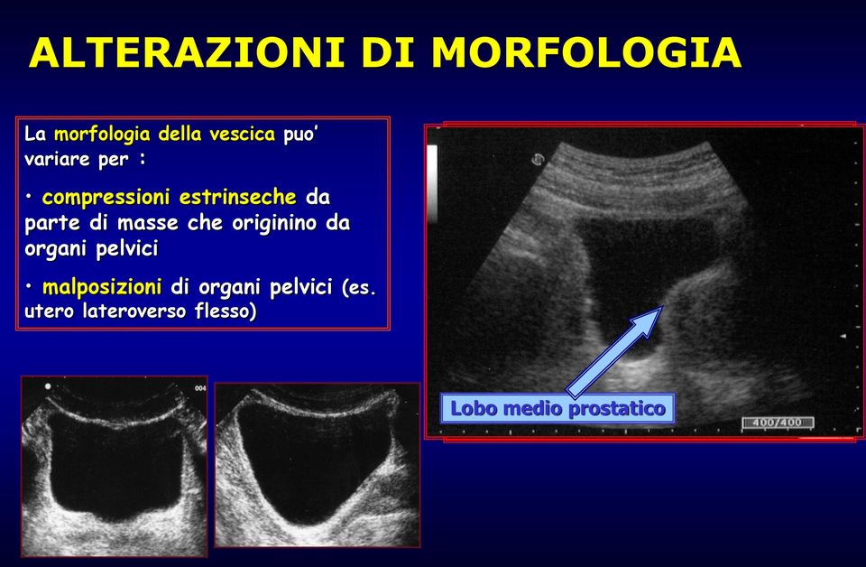 originino da organi pelvici malposizioni di organi pelvici (es.