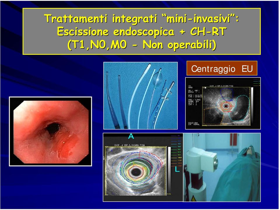 Escissione endoscopica +