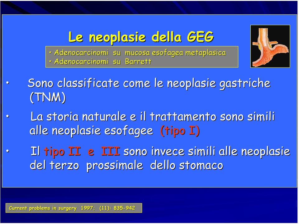 trattamento sono simili alle neoplasie esofagee (tipo I) Il tipo II e III sono invece