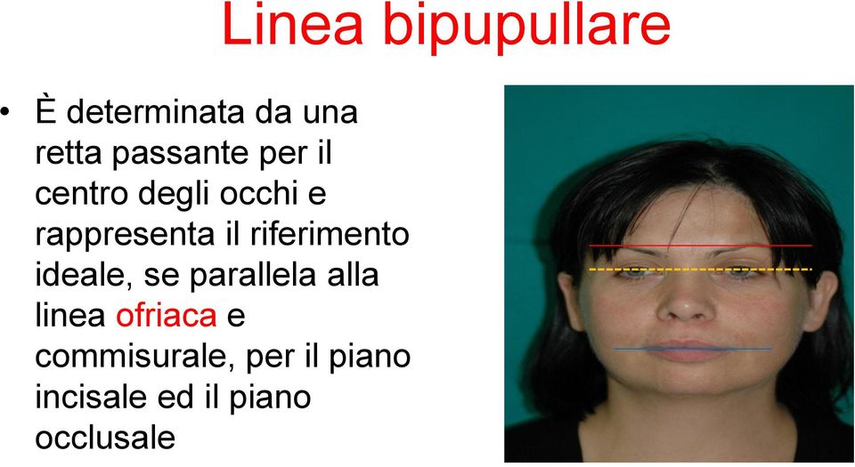 parallela alla linea ofriaca e commisurale, per il