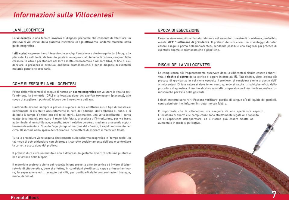 Le cellule di tale tessuto, poste in un appropriato terreno di coltura, vengono fatte crescere in vitro e poi studiate nel loro assetto cromosomico o nel loro DNA, al fine di evidenziare la presenza