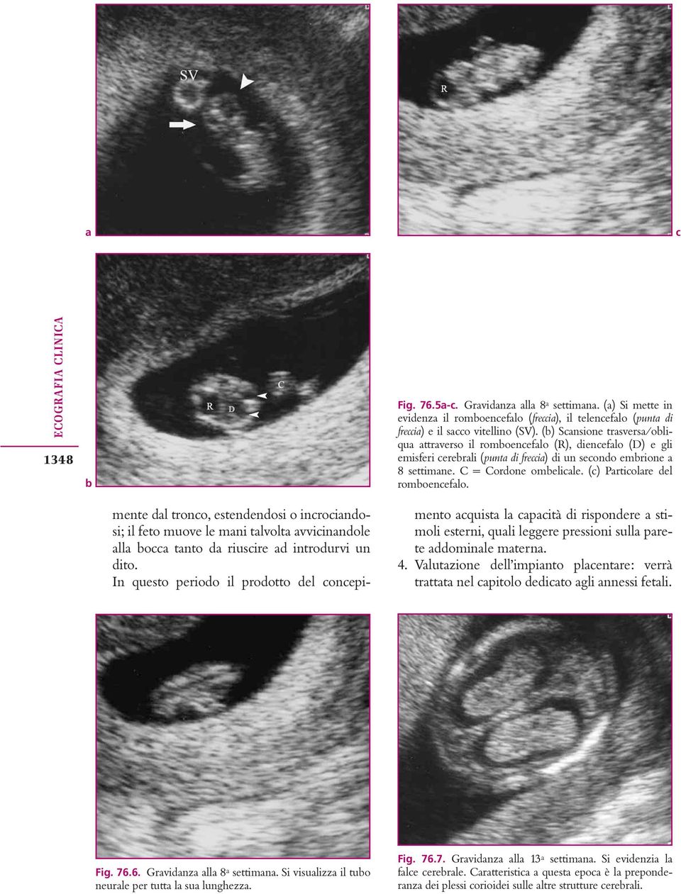 (c) Particolare del romoencefalo. mente dal tronco, estendendosi o incrociandosi; il feto muove le mani talvolta avvicinandole alla occa tanto da riuscire ad introdurvi un dito.