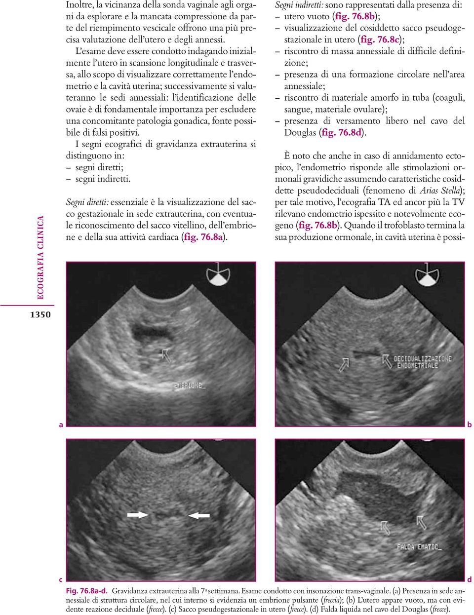 L esame deve essere condotto indagando inizialmente l utero in scansione longitudinale e trasversa, allo scopo di visualizzare correttamente l endometrio e la cavità uterina; successivamente si