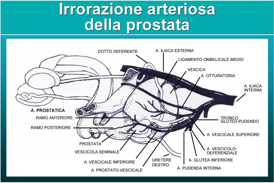 PROSTATICA RAMO ANTERIORE RAMO POSTERIORE TRONCO GLUTEO-PUDENDO A.