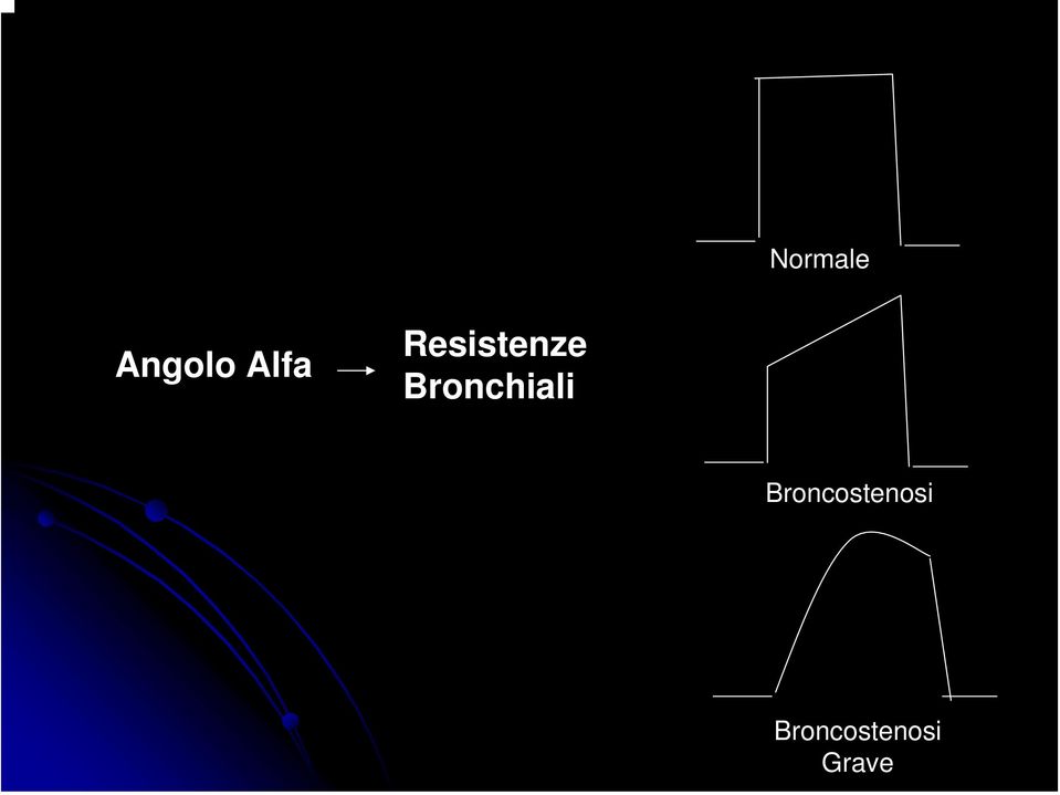 Bronchiali