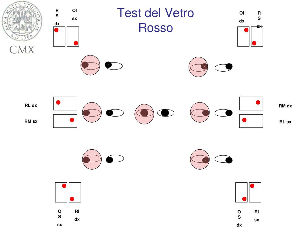 sx RL sx RL RM PP RM RL Diplopia si /