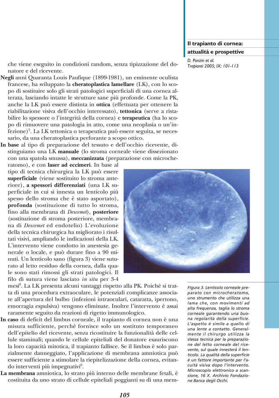 una cornea alterata, lasciando intatte le strutture sane più profonde.