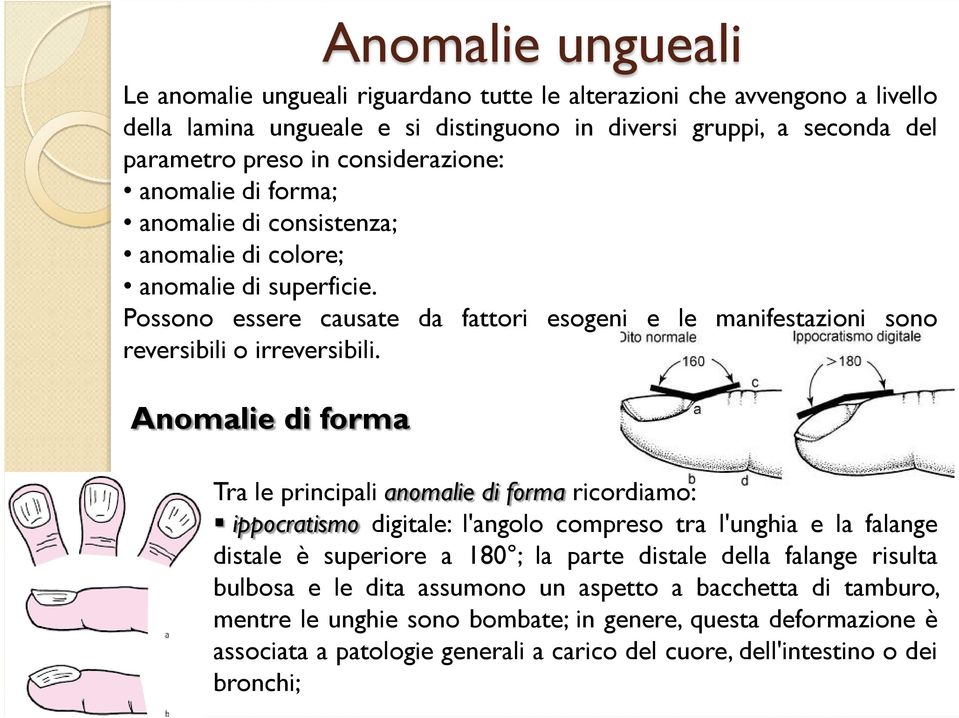 Anomalie di forma Anomalie ungueali Tra le principali anomalie di forma ricordiamo: ippocratismo digitale: l'angolo compreso tra l'unghia e la falange distale è superiore a 180 ; la parte distale