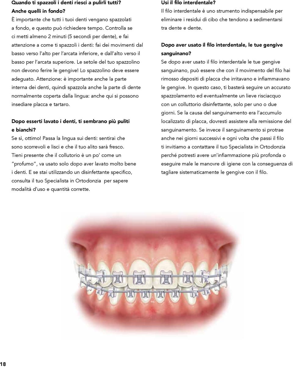 per l arcata superiore. Le setole del tuo spazzolino non devono ferire le gengive! Lo spazzolino deve essere adeguato.