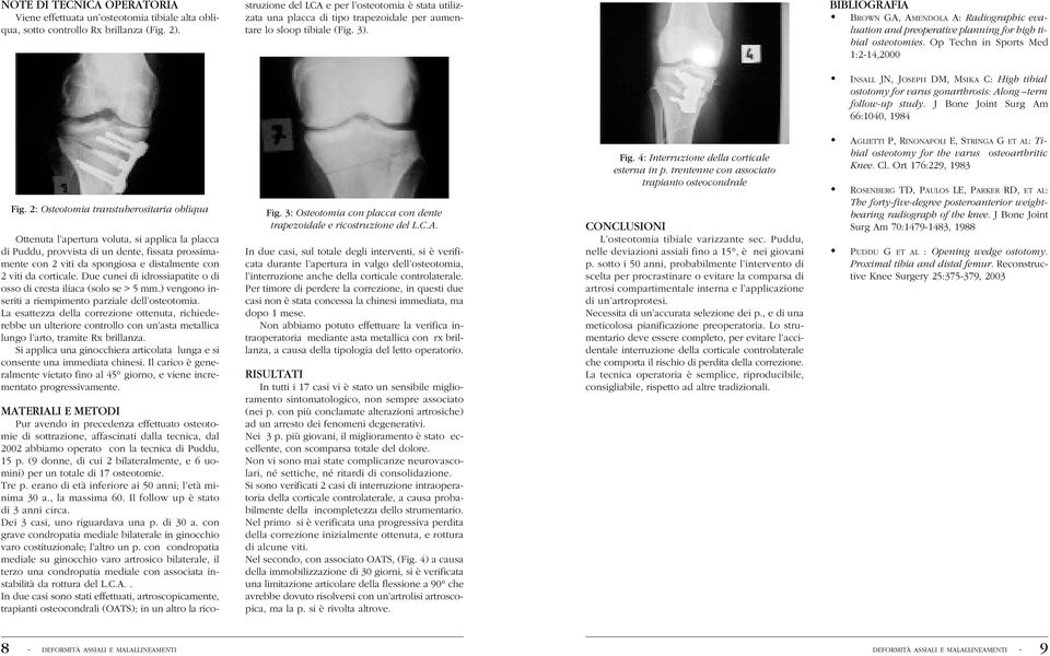 BIBLIOGRAFIA BROWN GA, AMENDOLA A: Radiographic evaluation and preoperative planning for high tibial osteotomies.