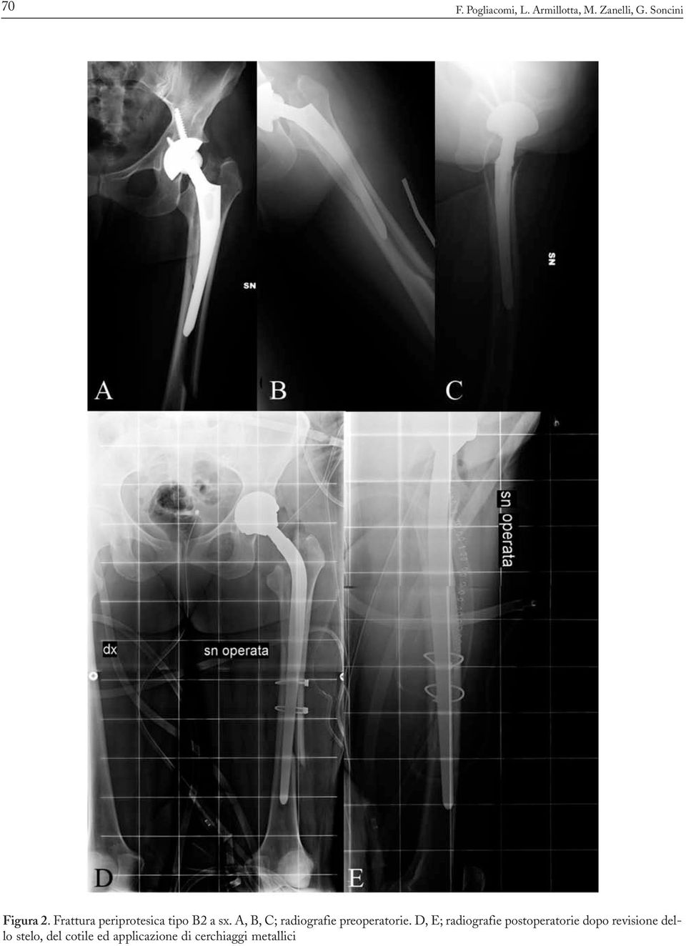 A, B, C; radiografie preoperatorie.
