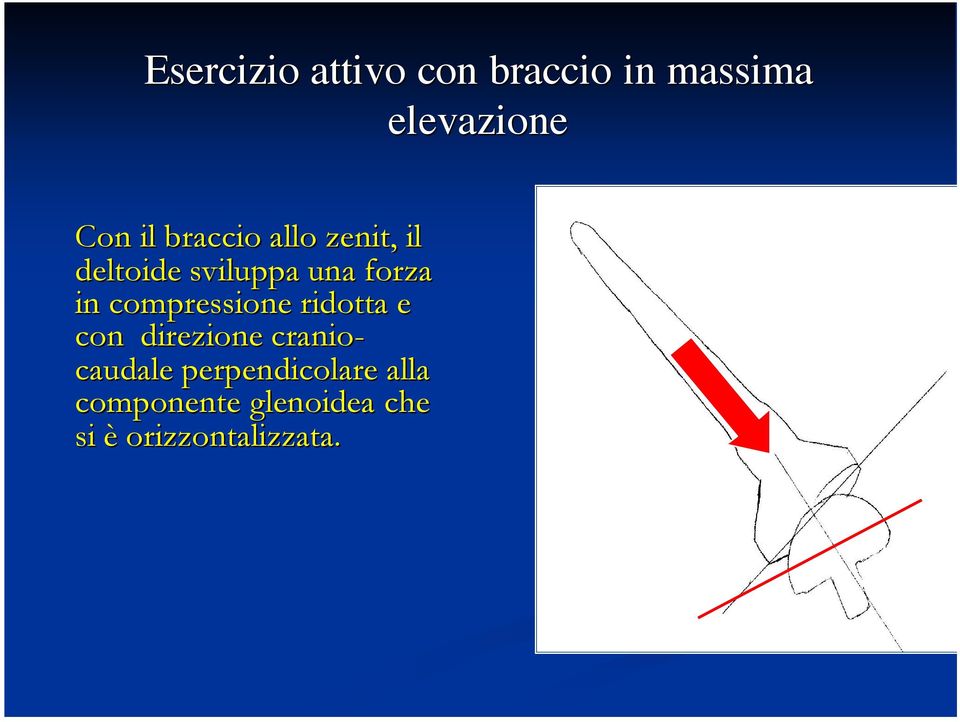 compressione ridotta e con direzione cranio- caudale