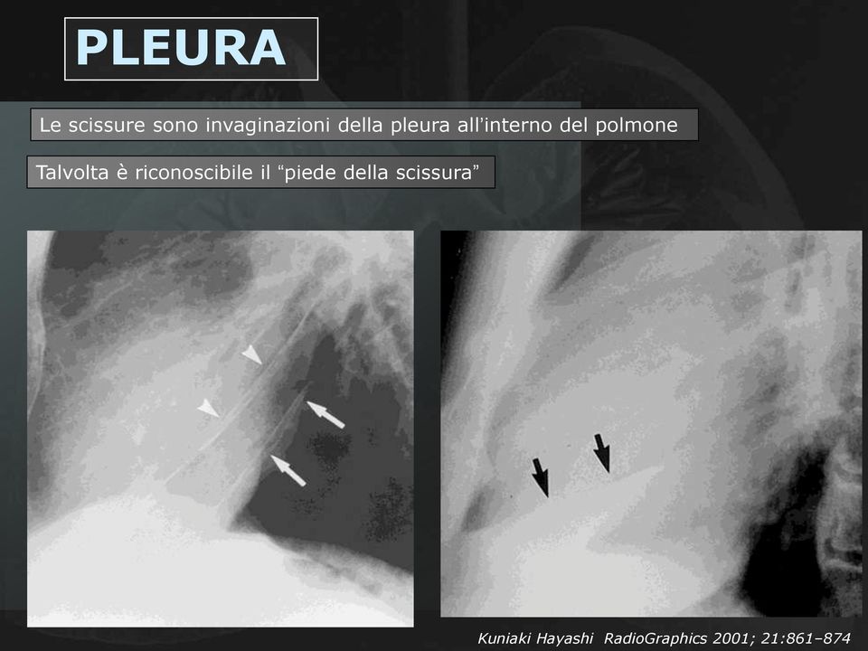 Talvolta è riconoscibile il piede della