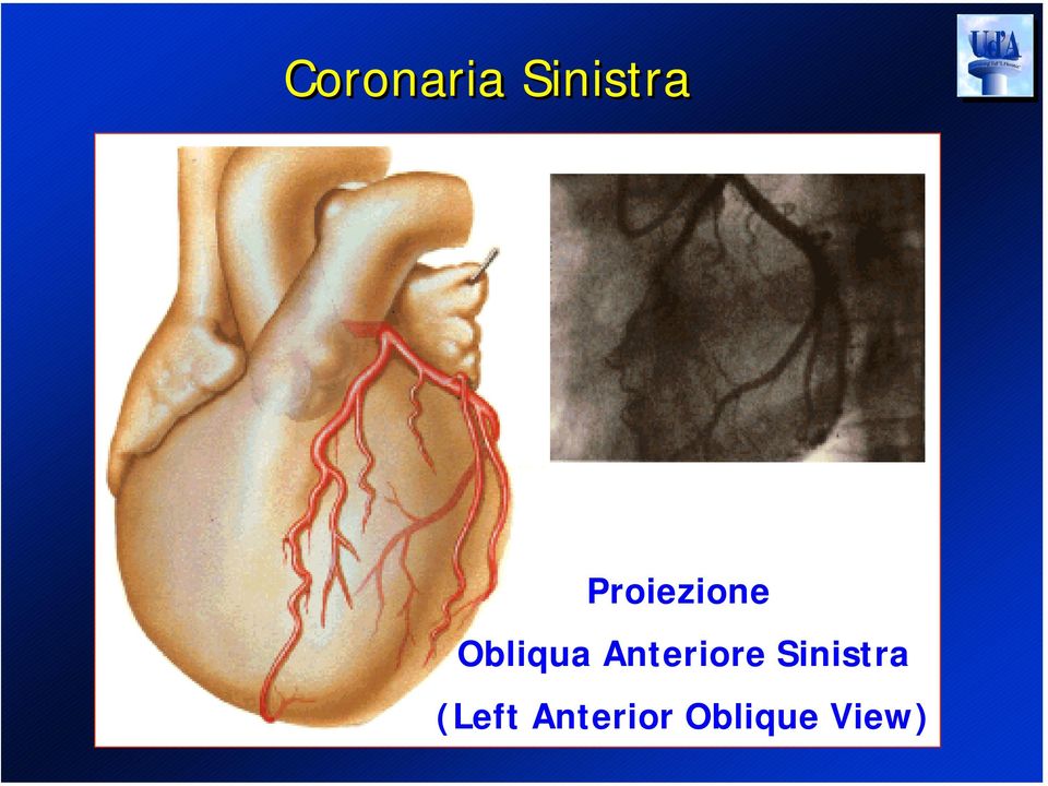 Anteriore Sinistra