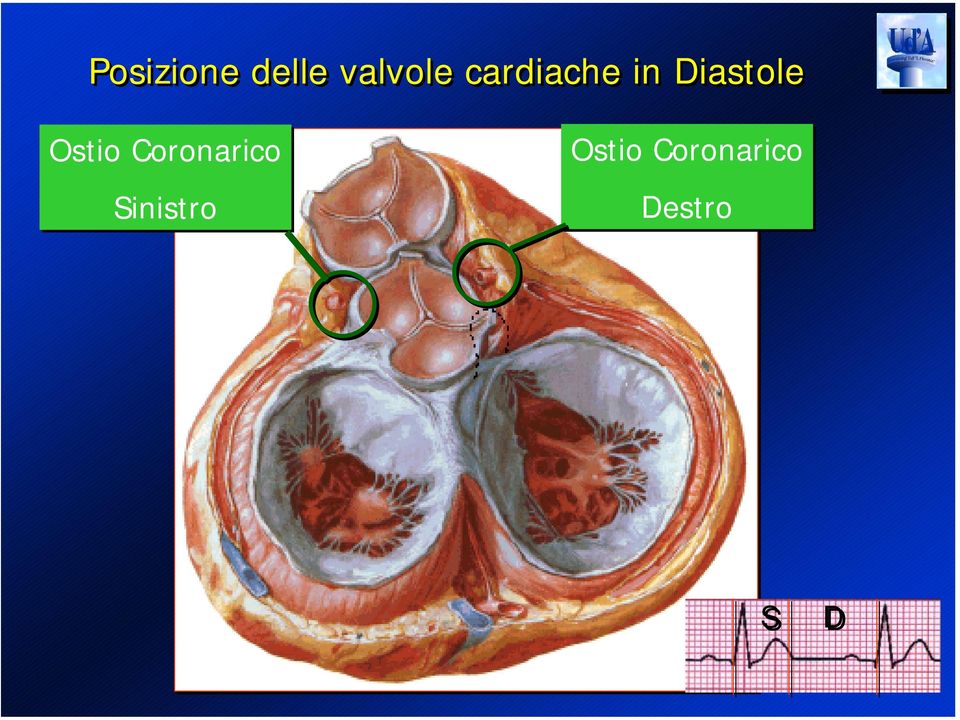 Ostio Coronarico