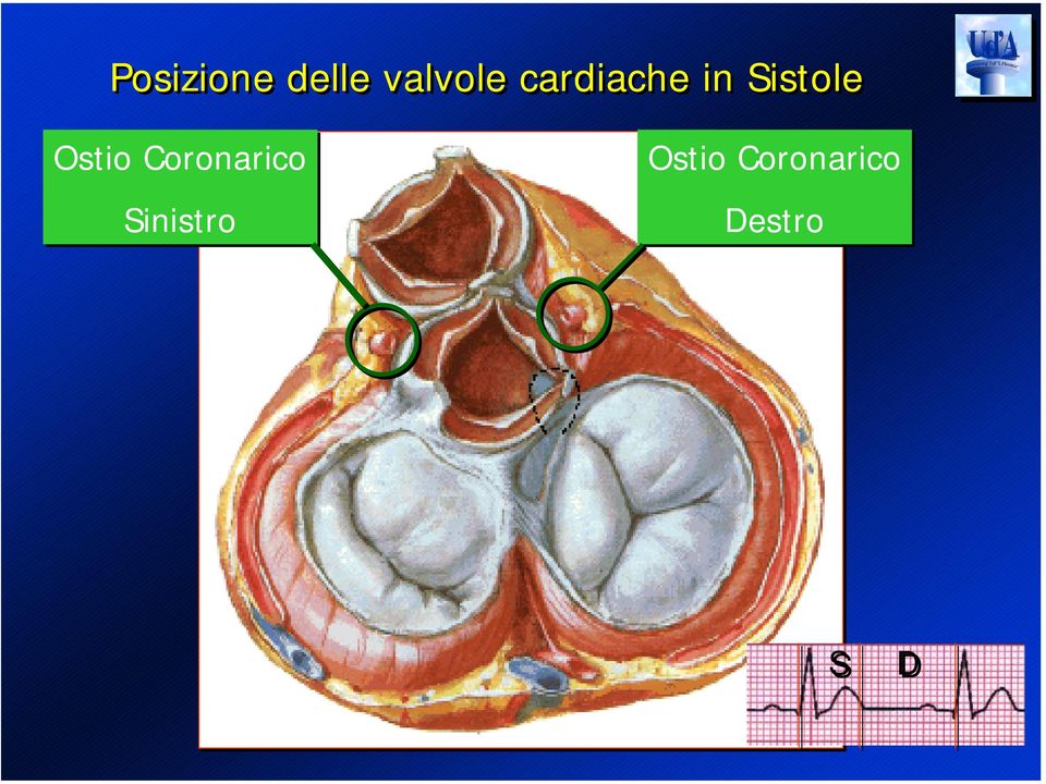 Ostio Coronarico