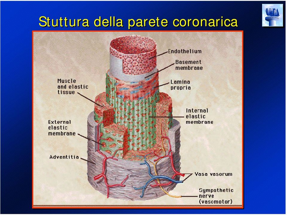 parete