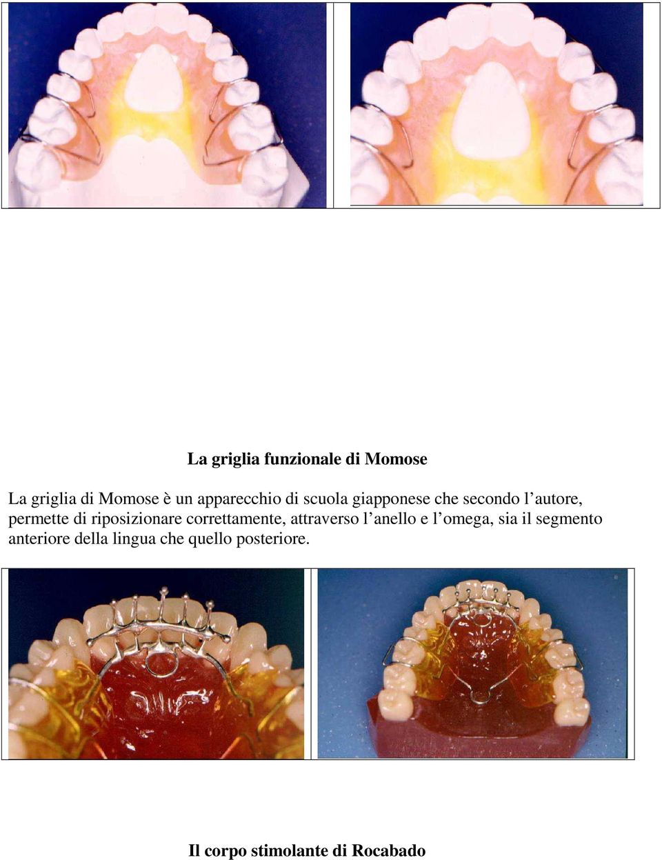 correttamente, attraverso l anello e l omega, sia il segmento