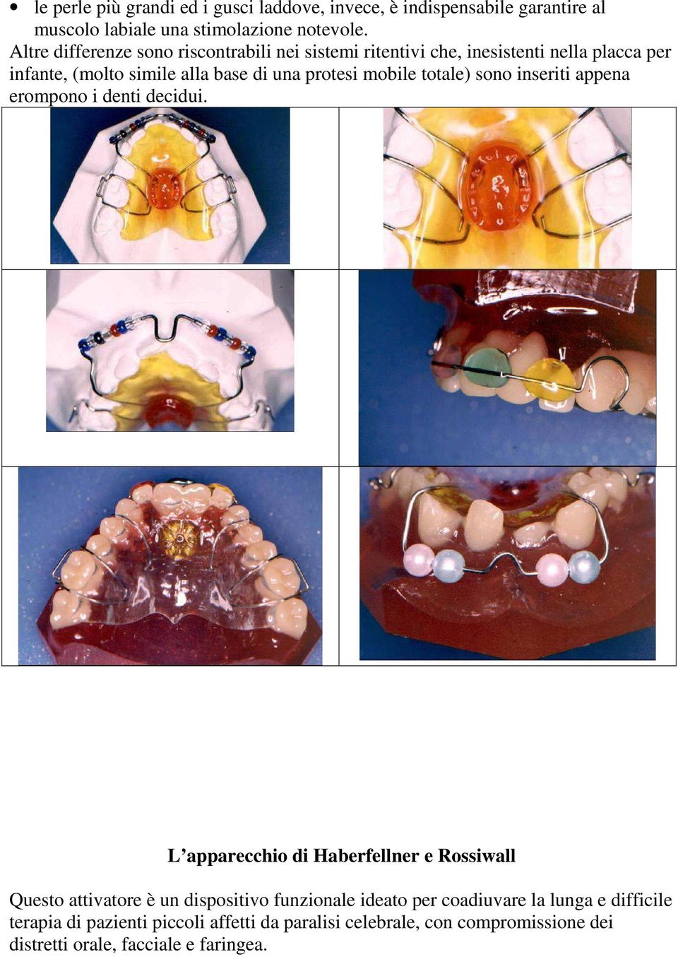 mobile totale) sono inseriti appena erompono i denti decidui.