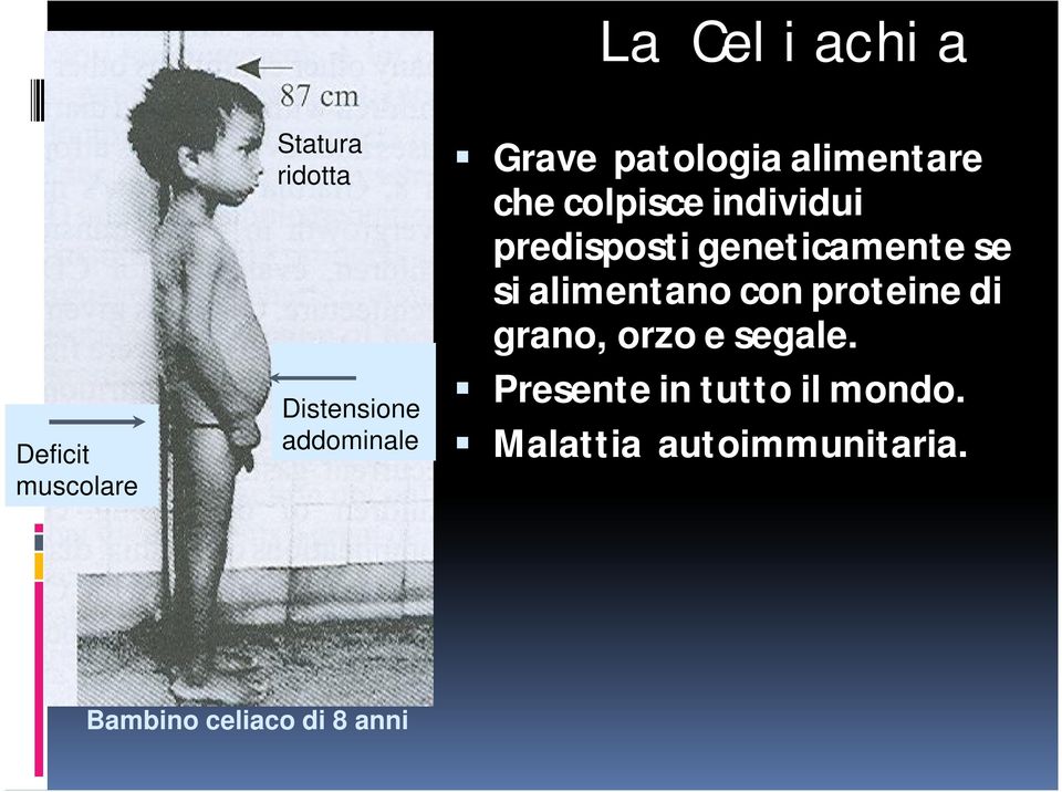 geneticamente se si alimentano con proteine di grano, orzo e segale.