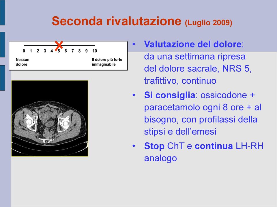 Si consiglia: ossicodone + paracetamolo ogni 8 ore + al bisogno,