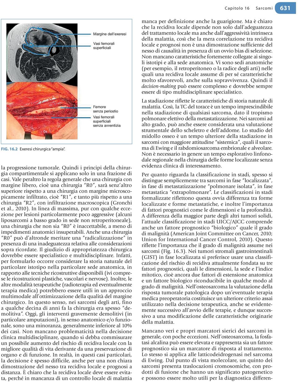 Vale peraltro la regola generale che una chirurgia con margine libero, cioè una chirurgia R0, sarà senz altro superiore rispetto a una chirurgia con margine microscopicamente infiltrato, cioè R1, e