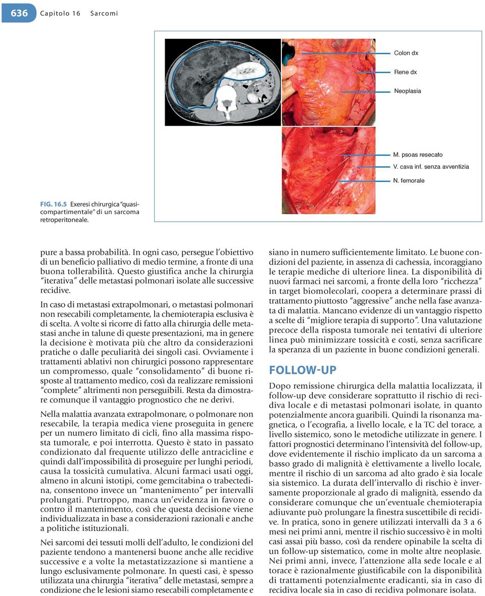 Questo giustifica anche la chirurgia iterativa delle metastasi polmonari isolate alle successive recidive.