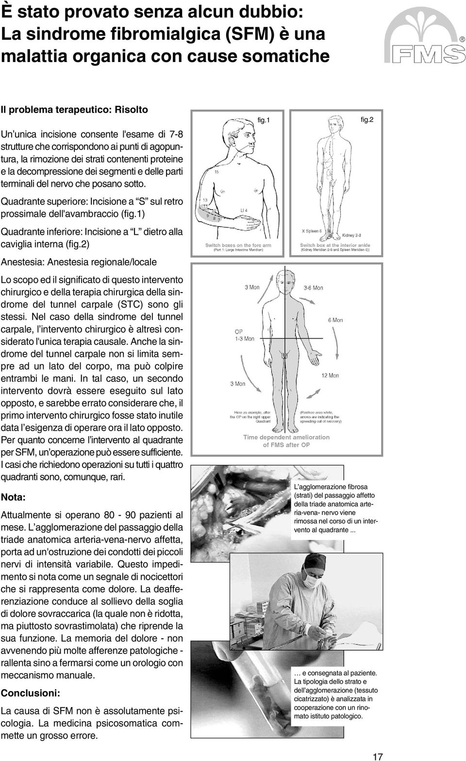 Quadrante superiore: Incisione a S sul retro prossimale dell'avambraccio (fig.1) Quadrante inferiore: Incisione a L dietro alla caviglia interna (fig.