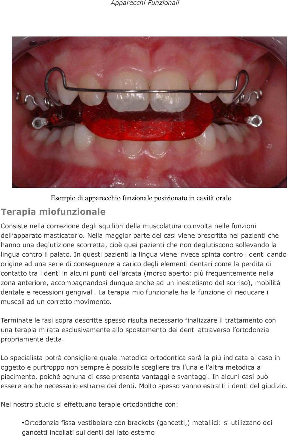 In questi pazienti la lingua viene invece spinta contro i denti dando origine ad una serie di conseguenze a carico degli elementi dentari come la perdita di contatto tra i denti in alcuni punti dell