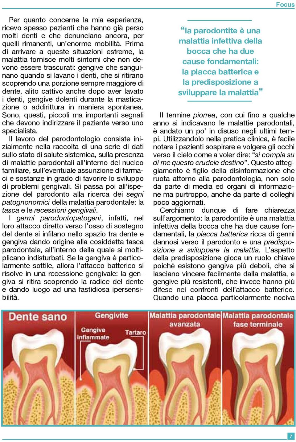 porzione sempre maggiore di dente, alito cattivo anche dopo aver lavato i denti, gengive dolenti durante la masticazione o addirittura in maniera spontanea.