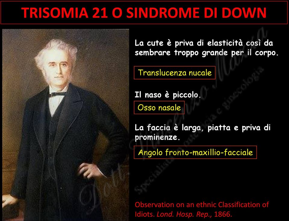 Osso nasale La faccia è larga, piatta e priva di prominenze.