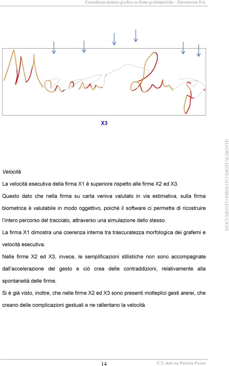 tracciato, attraverso una simulazione dello stesso. La firma X1 dimostra una coerenza interna tra trascuratezza morfologica dei grafemi e velocità esecutiva.