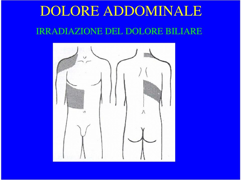 IRRADIAZIONE