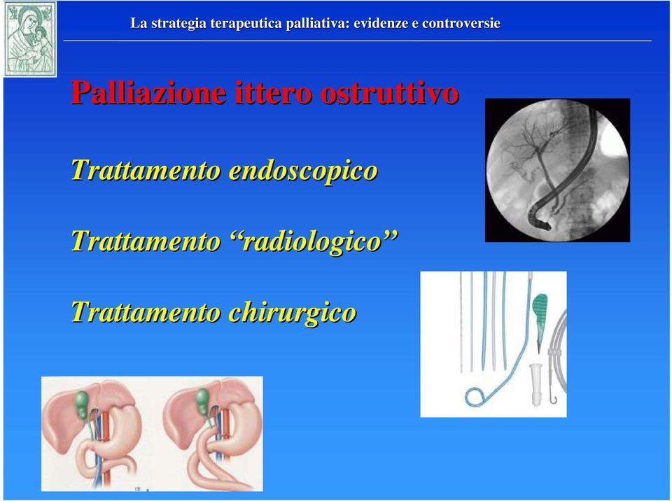 endoscopico Trattamento