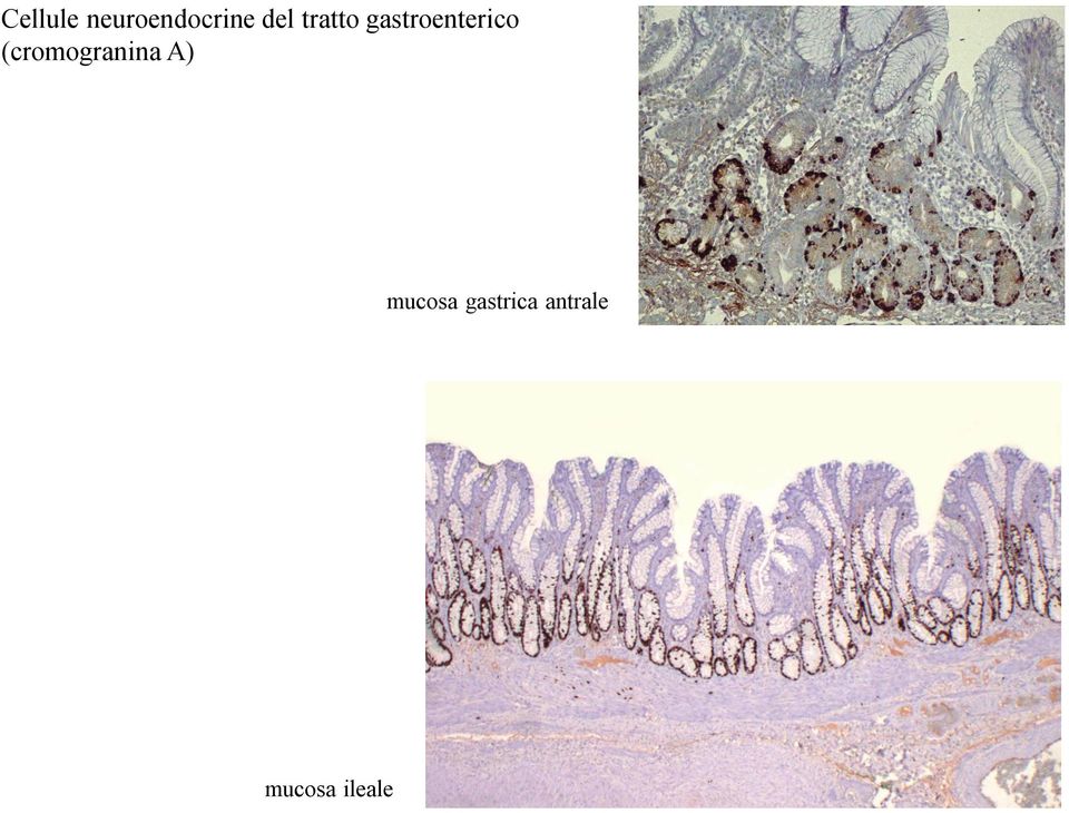 (cromogranina A) mucosa