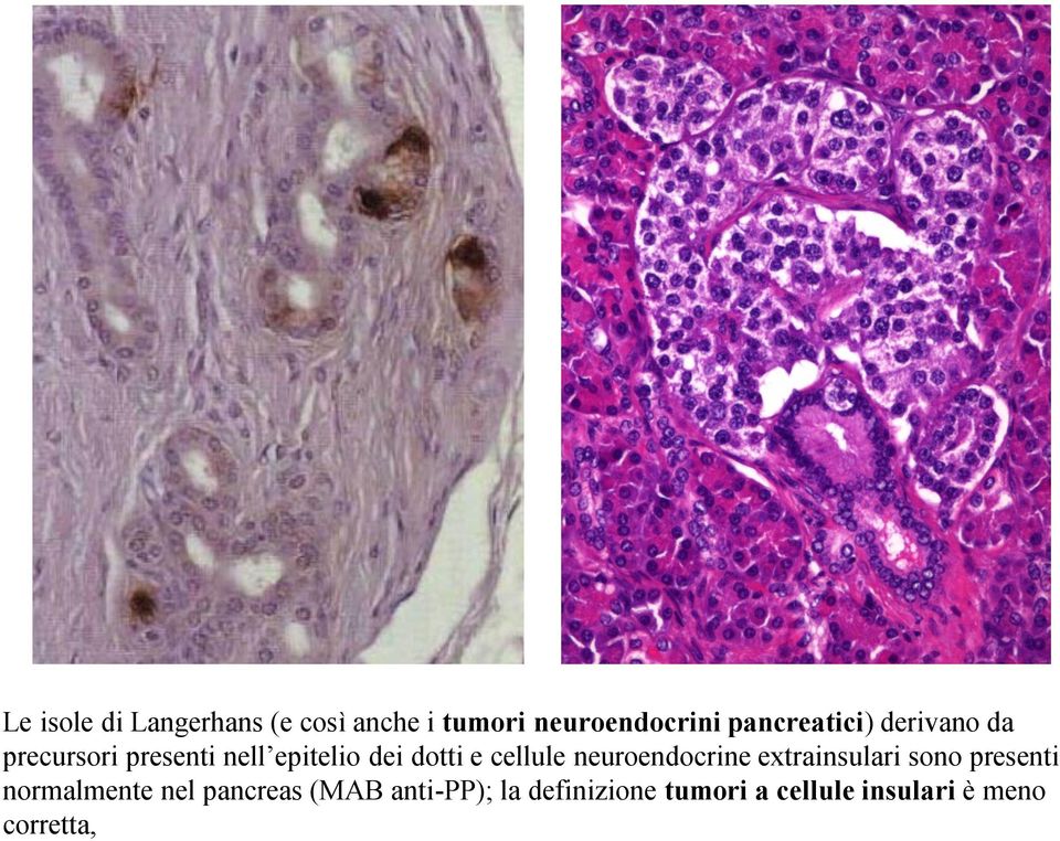 e cellule neuroendocrine extrainsulari sono presenti normalmente nel