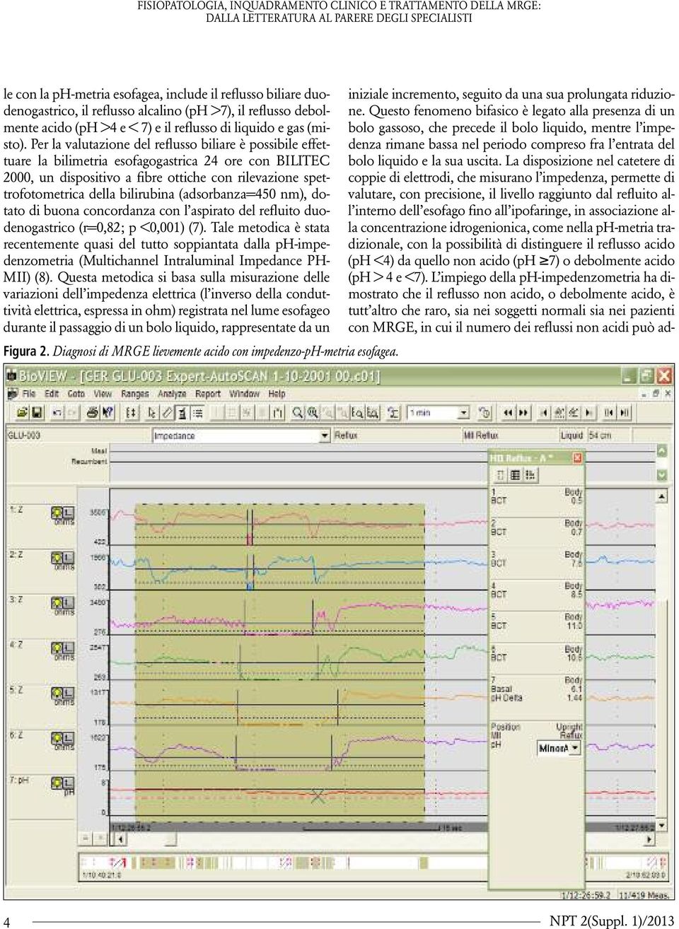 bilirubina (adsorbanza=450 nm), dotato di buona concordanza con l aspirato del refluito duodenogastrico (r=0,82; p <0,001) (7).