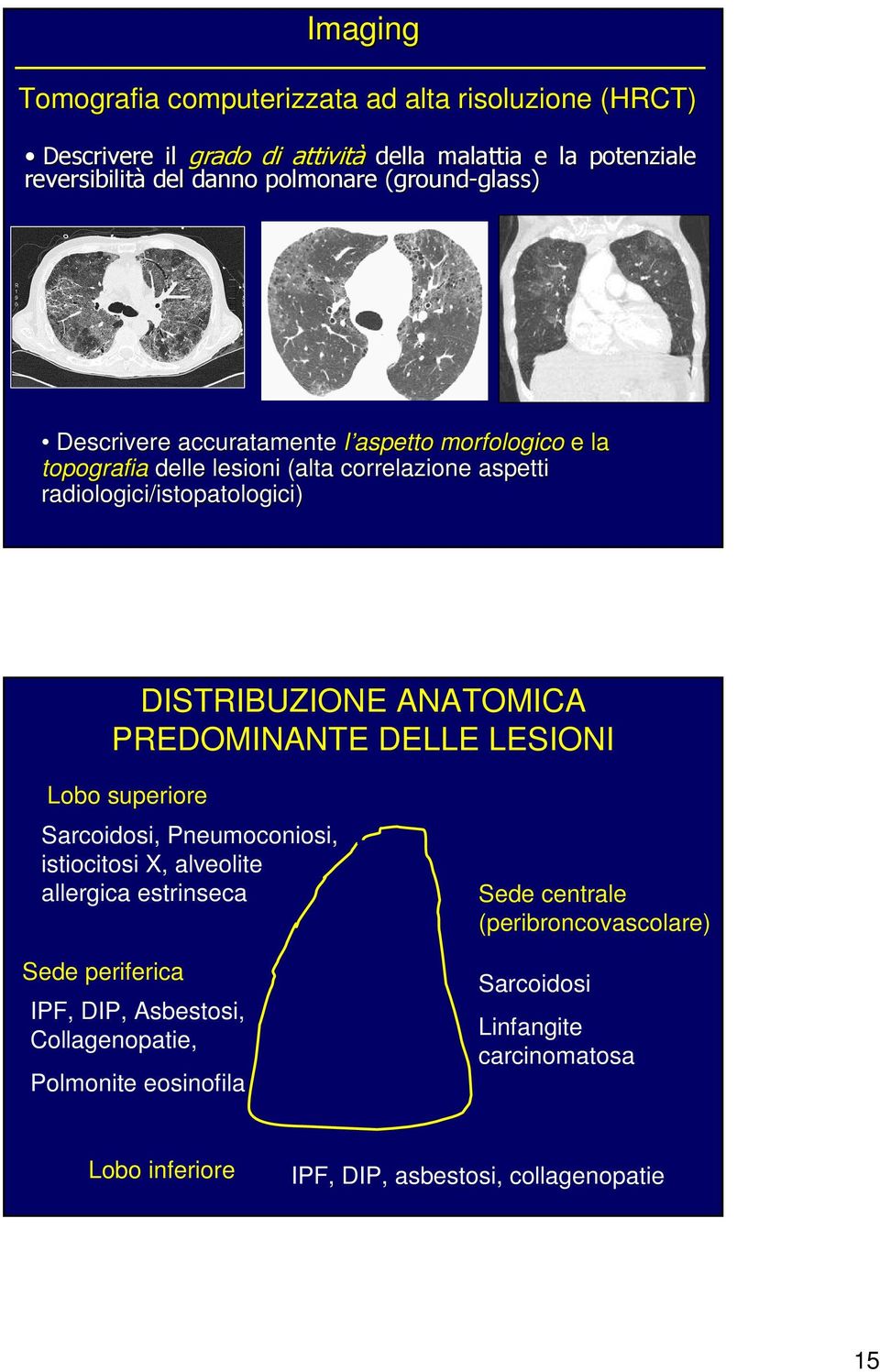 DISTRIBUZIONE ANATOMICA PREDOMINANTE DELLE LESIONI Lobo superiore Sarcoidosi, Pneumoconiosi, istiocitosi X, alveolite allergica estrinseca Sede periferica IPF, DIP,