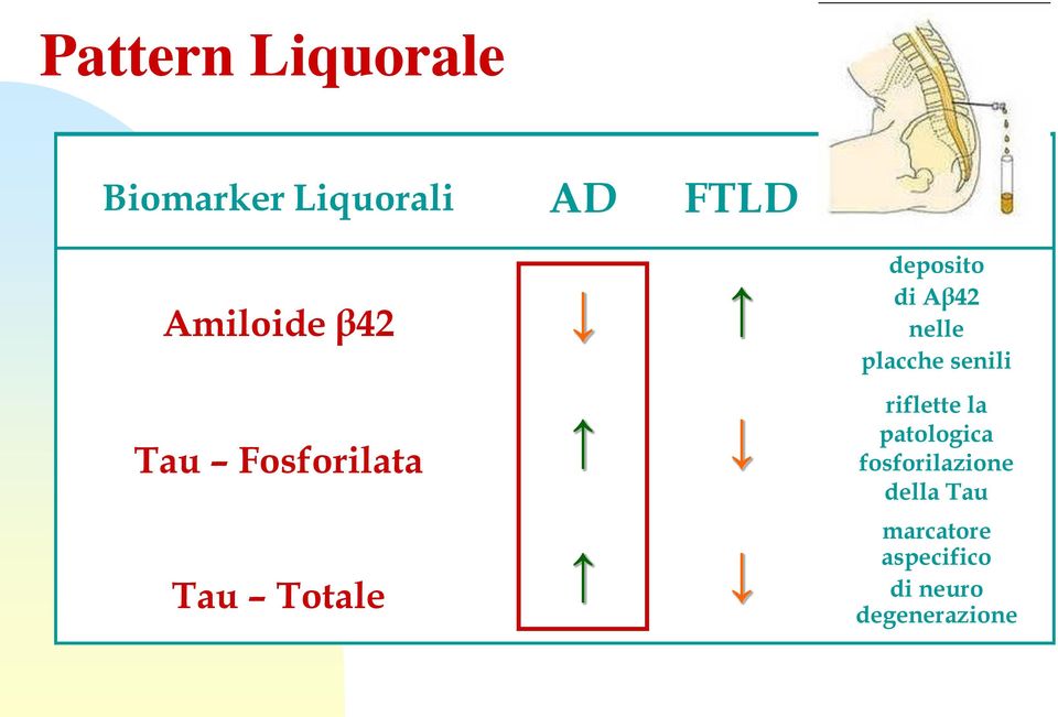 Aβ42 nelle placche senili riflette la patologica