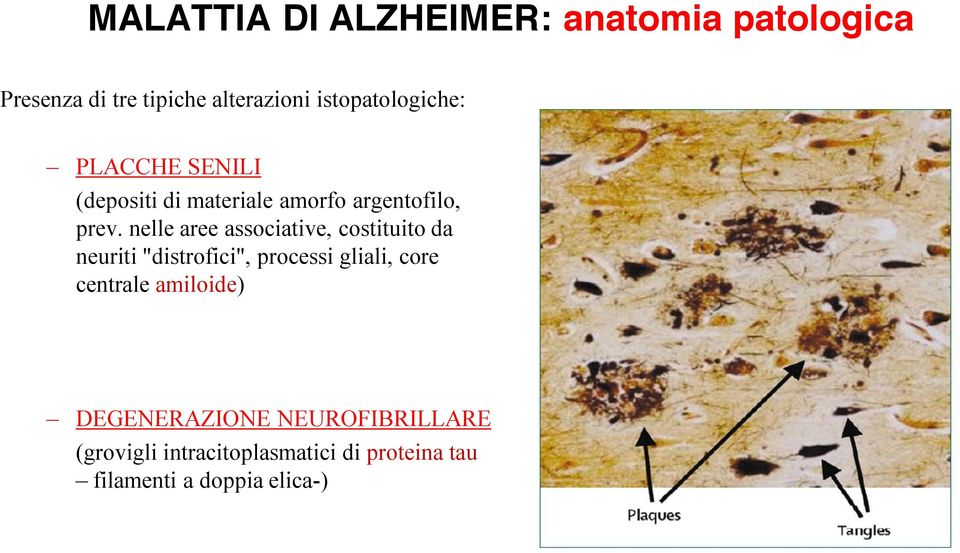 nelle aree associative, costituito da neuriti "distrofici", processi gliali, core centrale