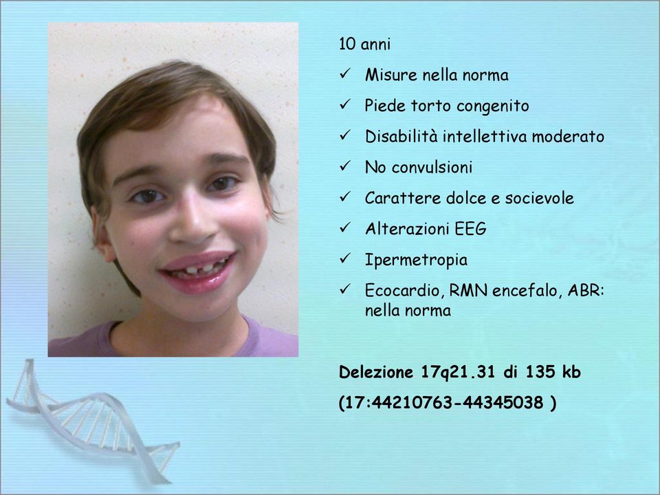 socievole Alterazioni EEG Ipermetropia Ecocardio, RMN